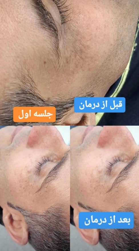 مرکز پاکسازی پوست و زیبایی الهام تقوی در امیدیه
